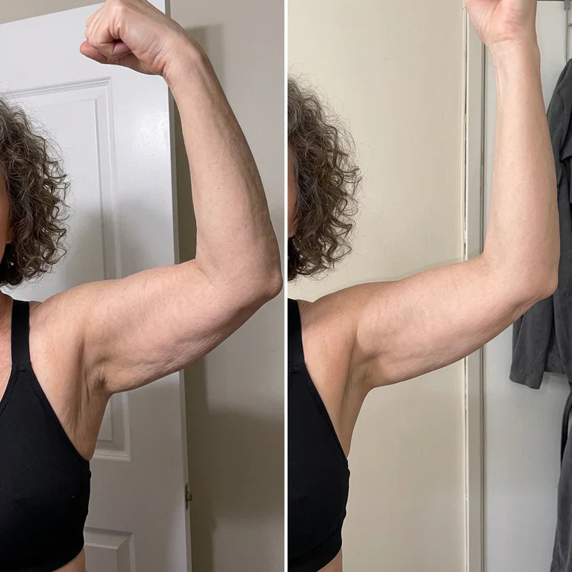 Armivia Arm-Manschette