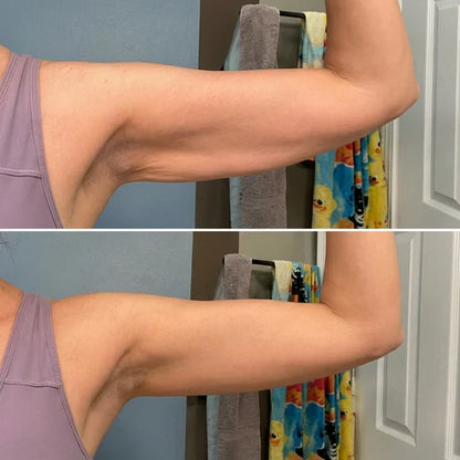 Armivia Arm-Manschette