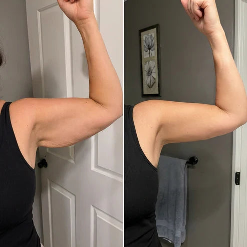 Armivia Arm-Manschette