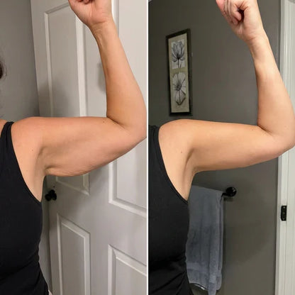 Armivia Arm-Manschette