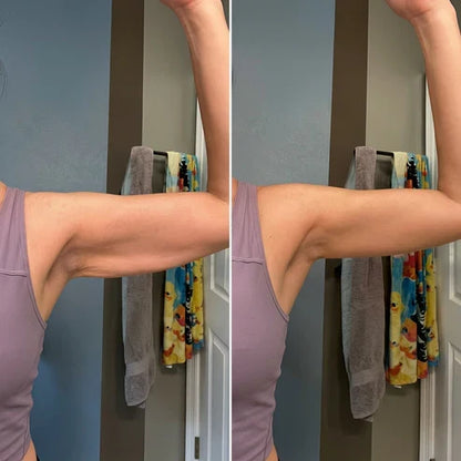 Armivia Arm-Manschette
