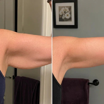 Armivia Arm-Manschette