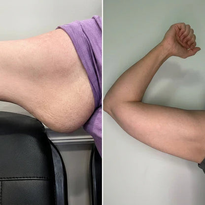 Armivia Arm-Manschette